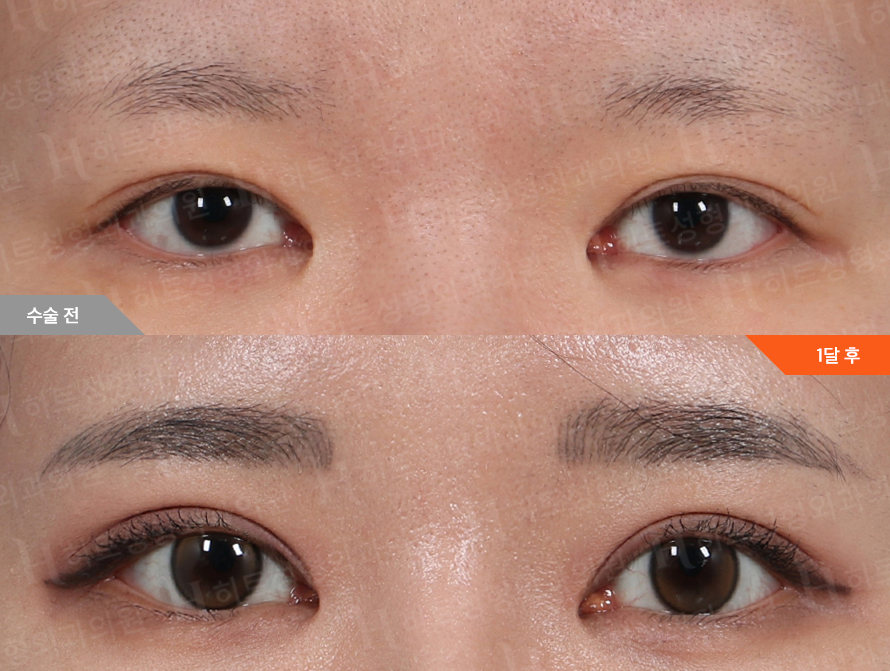 Before