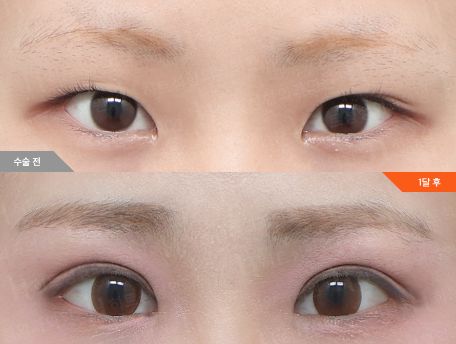 Before
