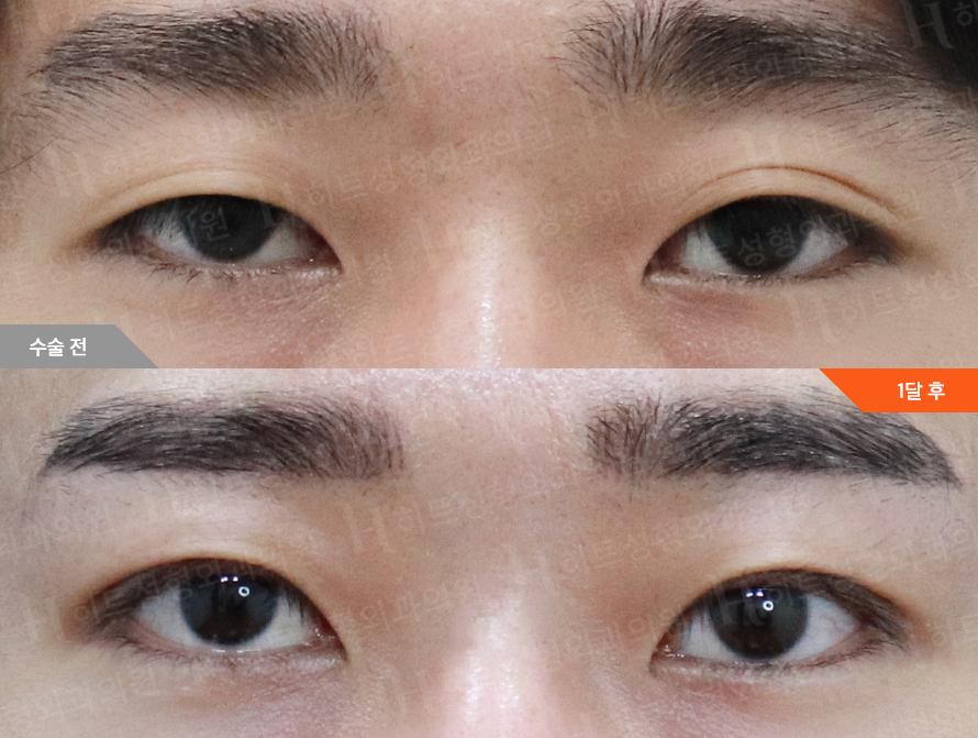 Before